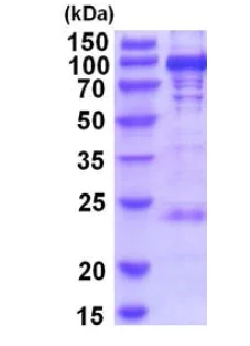 SDS-PAGE - Recombinant Human PYGL protein (AB202149)