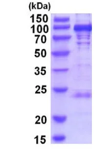 SDS-PAGE - Recombinant Human PYGL protein (His tag N-Terminus) (AB202149)