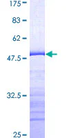 SDS-PAGE - Recombinant Human PYK2 protein (GST tag N-Terminus) (AB152380)