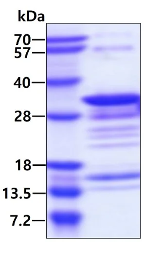 SDS-PAGE - Recombinant Human PYM protein (His tag C-Terminus) (AB98083)