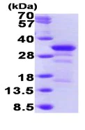 SDS-PAGE - Recombinant Human PYM protein (His tag C-Terminus) (AB98083)