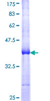 Recombinant Human Pyrin protein