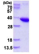 SDS-PAGE - Recombinant Human Pyrophosphatase 1 protein (AB123186), expandable thumbnail