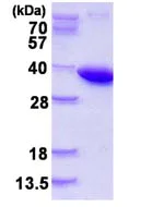 SDS-PAGE - Recombinant Human Pyrophosphatase 1 protein (His tag N-Terminus) (AB123186)