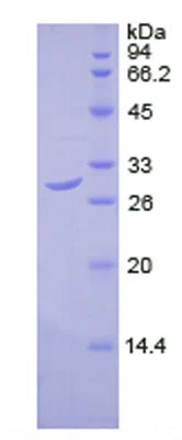 SDS-PAGE - Recombinant Human Pyruvate Dehydrogenase E2 protein (His tag) (AB275559)