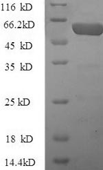 SDS-PAGE - Recombinant Human PZP protein (His tag) (AB224853)