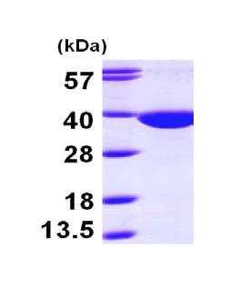 SDS-PAGE - Recombinant Human QPRT protein (His tag N-Terminus) (AB100986)