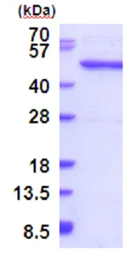 SDS-PAGE - Recombinant Human QTRTD1 protein (His tag N-Terminus) (AB187456)