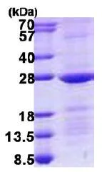 SDS-PAGE - Recombinant Human RAB10 protein (denatured) (His tag N-Terminus) (AB140063)