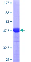 SDS-PAGE - Recombinant Human Rab11A protein (GST tag N-Terminus) (AB275911)