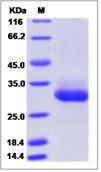 SDS-PAGE - Recombinant Human RAB11B protein (His tag) (AB276672), expandable thumbnail