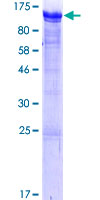 Recombinant Human RAB11FIP1 protein