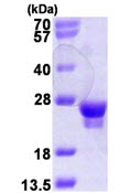 SDS-PAGE - Recombinant Human Rab18 protein (T7 tag N-Terminus) (AB115720)