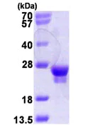 SDS-PAGE - Recombinant Human Rab18 protein (T7 tag N-Terminus) (AB115720)