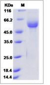 SDS-PAGE - Recombinant Human RAB1B protein (Fc Chimera) (AB276657)
