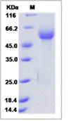SDS-PAGE - Recombinant Human RAB1B protein (Fc Chimera) (AB276657)