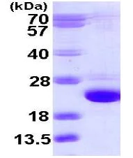 SDS-PAGE - Recombinant Human Rab24 protein (His tag N-Terminus) (AB113161)