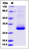 SDS-PAGE - Recombinant Human RAB27B protein (His tag) (AB276699)
