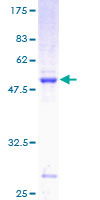 SDS-PAGE - Recombinant Human RAB29 protein (GST tag N-Terminus) (AB160266)