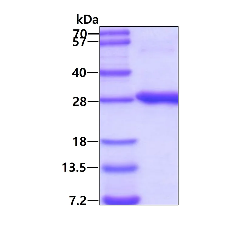 SDS-PAGE - Recombinant Human RAB2B protein (His tag N-Terminus) (AB116205)