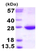 SDS-PAGE - Recombinant Human RAB31 protein (His tag N-Terminus) (AB124565)
