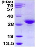 SDS-PAGE - Recombinant Human RAB32 protein (AB113131), expandable thumbnail