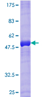 SDS-PAGE - Recombinant Human RAB33B protein (AB164395), expandable thumbnail