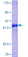 SDS-PAGE - Recombinant Human RAB33B protein (AB164395)
