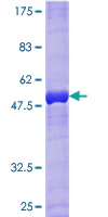 SDS-PAGE - Recombinant Human RAB33B protein (GST tag N-Terminus) (AB164395)
