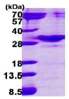 SDS-PAGE - Recombinant Human Rab34 protein (His tag N-Terminus) (AB115717)