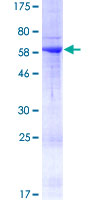 Recombinant Human RAB36 protein