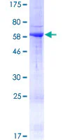SDS-PAGE - Recombinant Human RAB36 protein (GST tag N-Terminus) (AB160571)