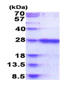SDS-PAGE - Recombinant Human RAB39B protein (His tag N-Terminus) (AB187445)
