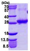 SDS-PAGE - Recombinant Human Rab3A protein (His tag N-Terminus) (AB109964)
