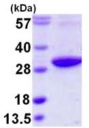 SDS-PAGE - Recombinant Human Rab3D protein (His tag N-Terminus) (AB109943)