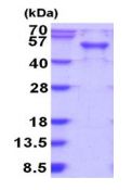 SDS-PAGE - Recombinant Human RAB3IL1 protein (AB187619), expandable thumbnail