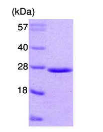 SDS-PAGE - Recombinant Human Rab5A protein (AB62956), expandable thumbnail