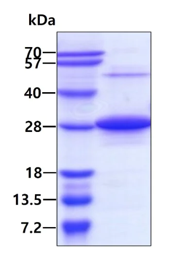 SDS-PAGE - Recombinant Human RAB7 protein (AB103507)