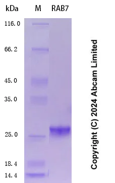 SDS-PAGE - Recombinant Human RAB7 Protein Standard (His tag) (AB323070)