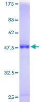SDS-PAGE - Recombinant Human RAB7B protein (AB166249)