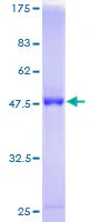 SDS-PAGE - Recombinant Human RAB7B protein (GST tag N-Terminus) (AB166249)
