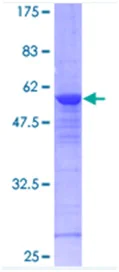 SDS-PAGE - Recombinant Human RAB8A protein (AB116785)