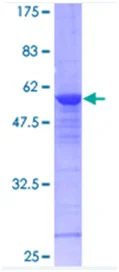 SDS-PAGE - Recombinant Human RAB8A protein (GST tag N-Terminus) (AB116785)