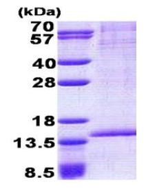 SDS-PAGE - Recombinant Human RAB8B protein (denatured) (AB167867)