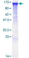 SDS-PAGE - Recombinant Human RABGAP1 protein (AB161730)