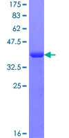 SDS-PAGE - Recombinant Human RABGAP1L/HHL protein (AB160709)