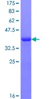 SDS-PAGE - Recombinant Human RABGAP1L/HHL protein (GST tag N-Terminus) (AB160709)