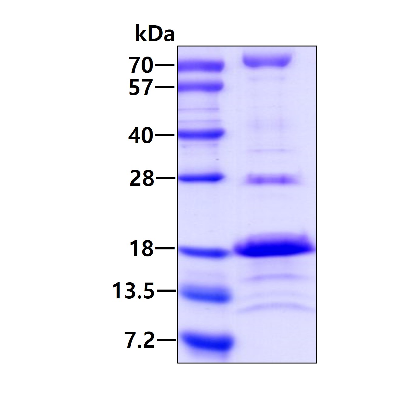 SDS-PAGE - Recombinant Human RABIF protein (His tag N-Terminus) (AB100886)