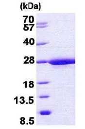 SDS-PAGE - Recombinant Human RABL5 protein (His tag N-Terminus) (AB156964)