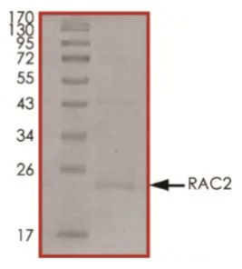 SDS-PAGE - Recombinant human RAC2 protein (Active) (AB268913)